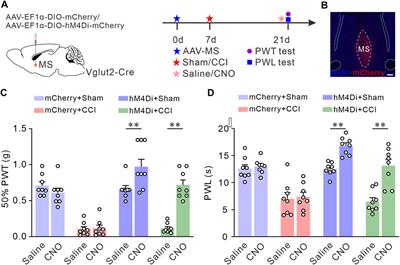 Medial septum glutamatergic neurons modulate nociception in chronic neuropathic pain via projections to lateral hypothalamus